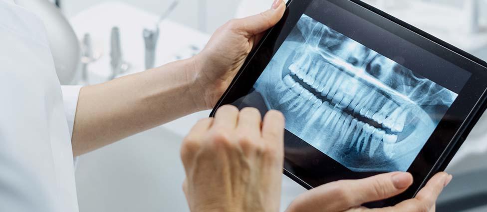 Explaining dental x-ray